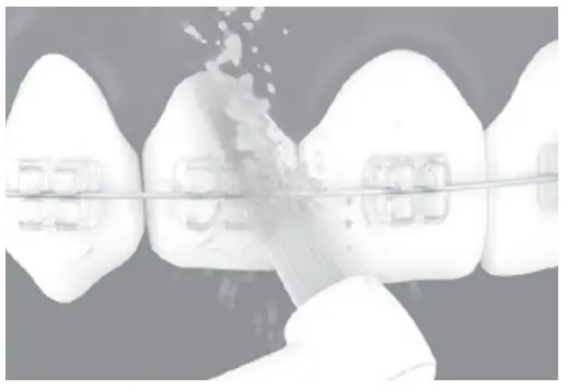 Panasonic EW1613 Oral Irrigator - Orthodontic nozzle1