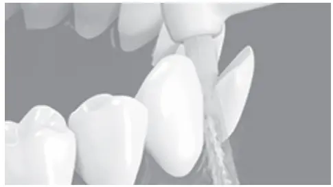 Panasonic EW1613 Oral Irrigator - crooked teeth