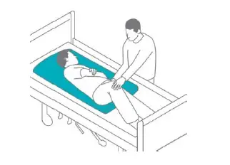 PETERMANN-OnlyU-PEM-Disposable-Sliding-Foil-fig-3