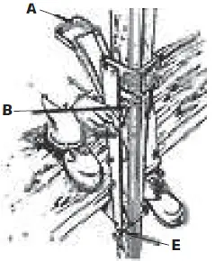 METALTECH 778300005918 Pump Jack System 12