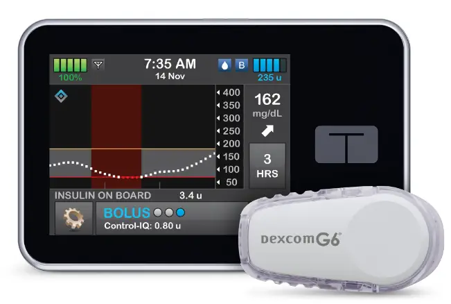 tandem-Insulin-Pump-and-Diabetes-Management-