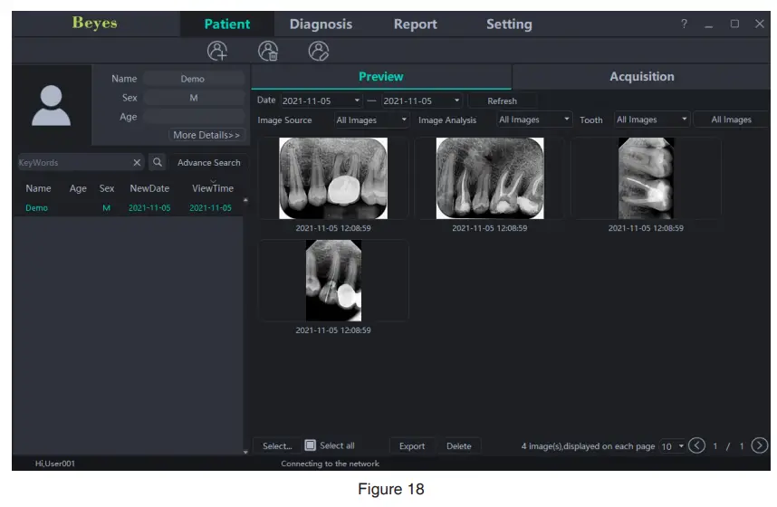 Beyes-BYS-DC1001-DURAY-Imaging-Plate-Scanner-17
