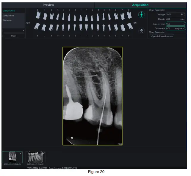 Beyes-BYS-DC1001-DURAY-Imaging-Plate-Scanner-19