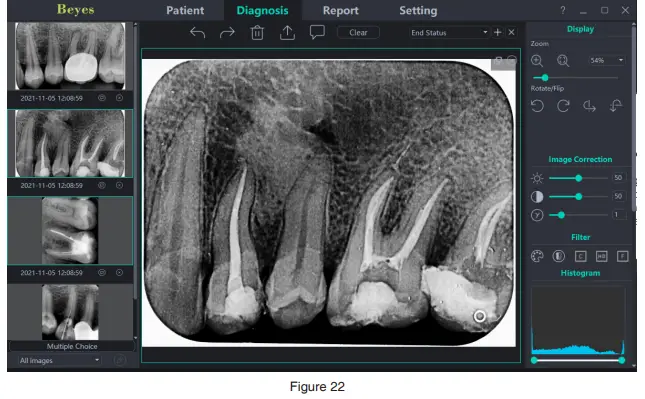 Beyes-BYS-DC1001-DURAY-Imaging-Plate-Scanner-21