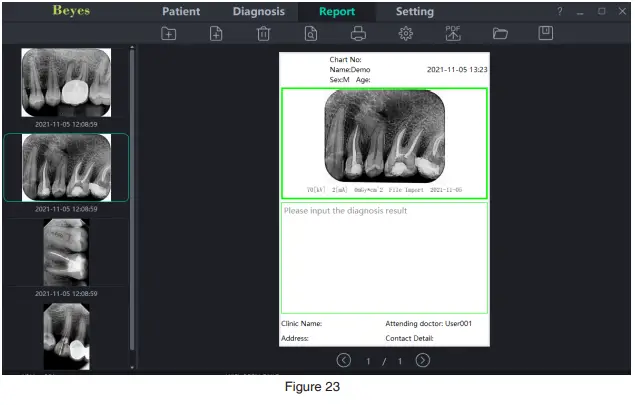 Beyes-BYS-DC1001-DURAY-Imaging-Plate-Scanner-22