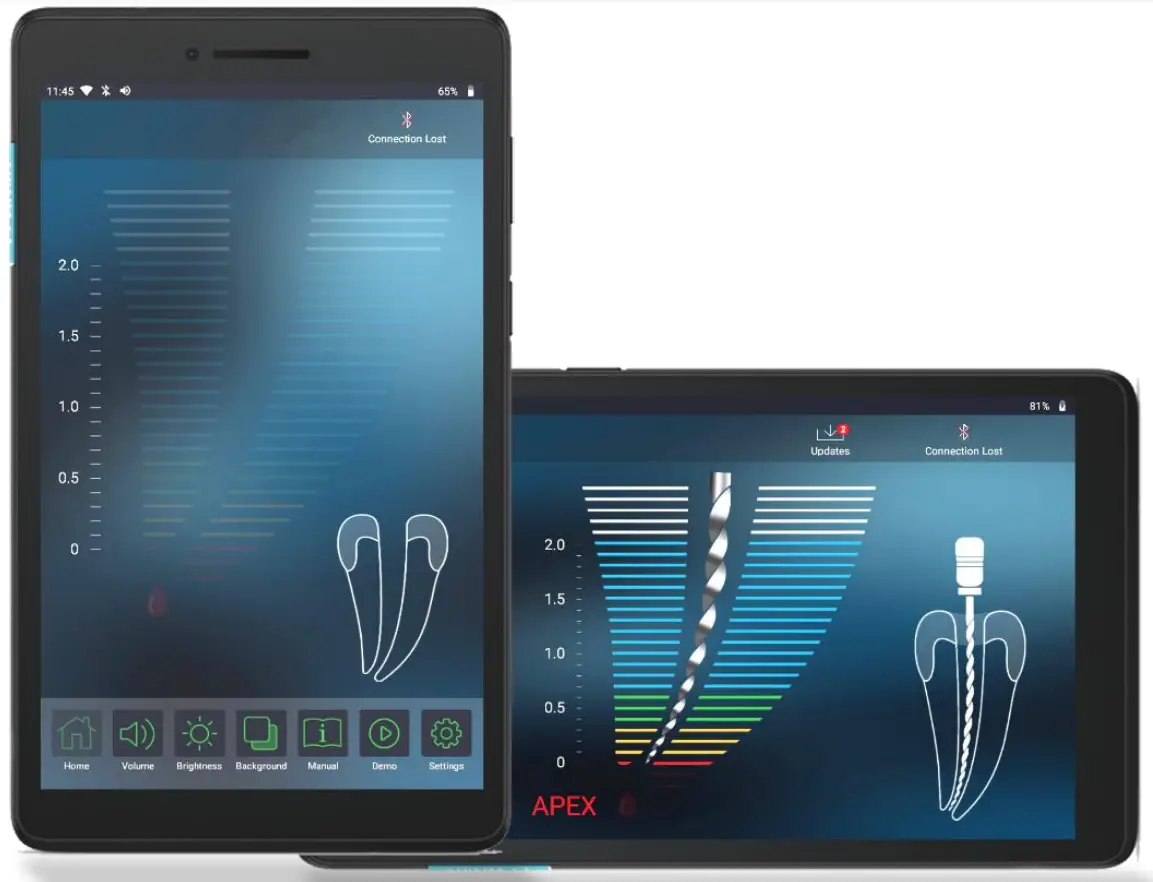 FORUMTEC Wirele X Smart Wireless Apex Locator