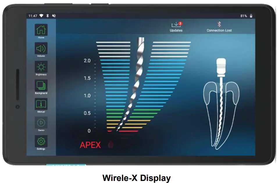 FORUMTEC Wirele X Smart Wireless Apex Locator - Display