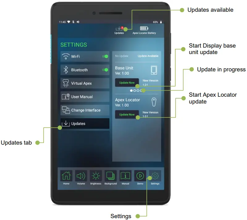 FORUMTEC Wirele X Smart Wireless Apex Locator - Update