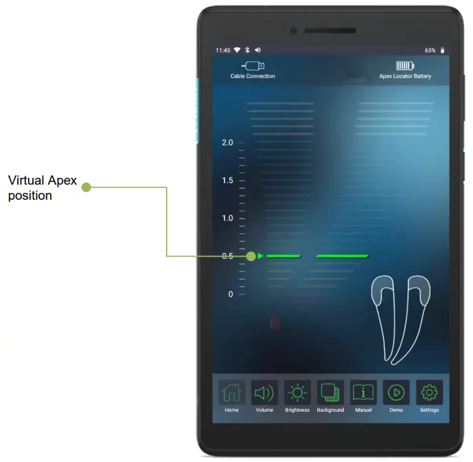 FORUMTEC Wirele X Smart Wireless Apex Locator - described