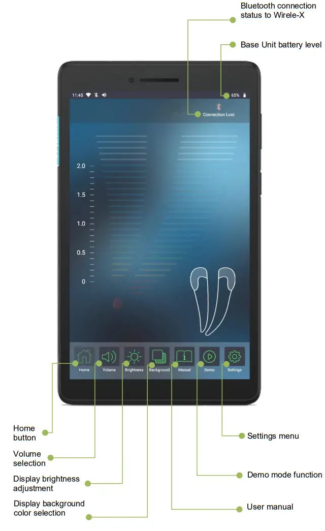 FORUMTEC Wirele X Smart Wireless Apex Locator - following
