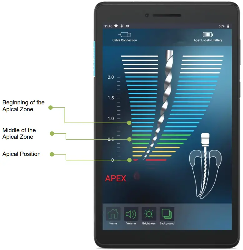 FORUMTEC Wirele X Smart Wireless Apex Locator - foramen
