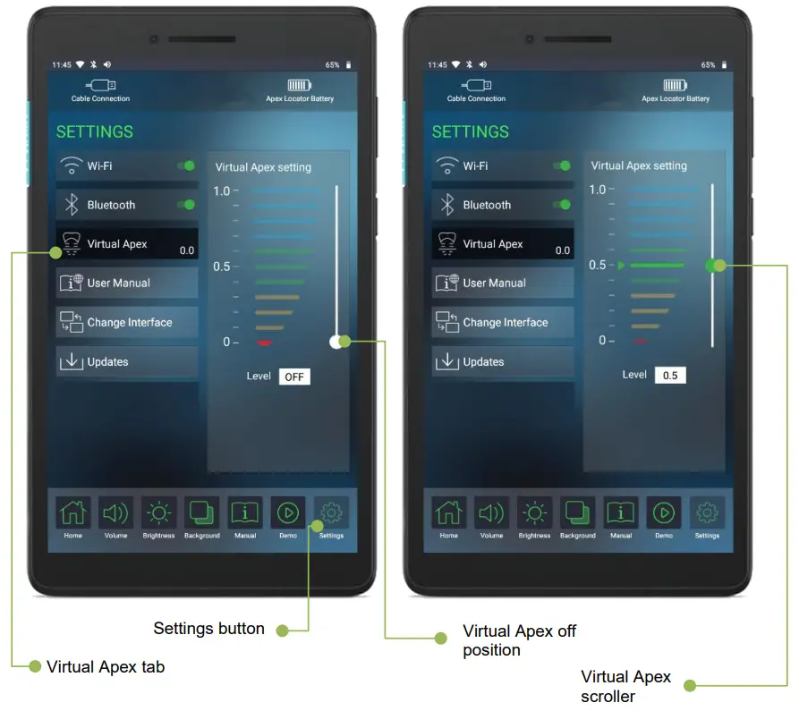 FORUMTEC Wirele X Smart Wireless Apex Locator - function