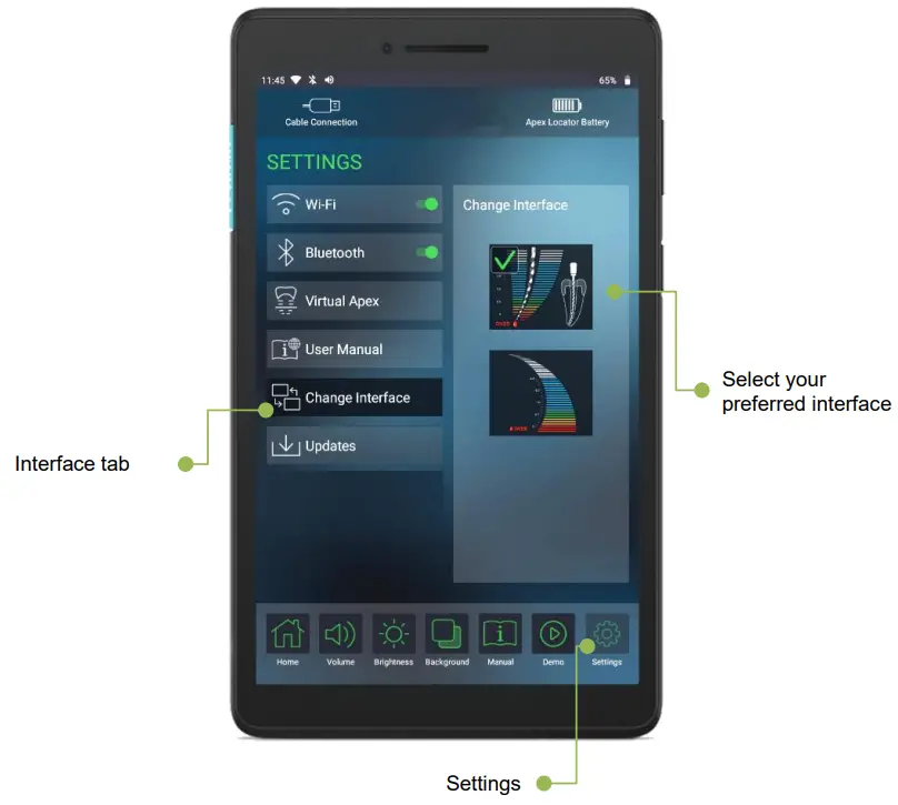 FORUMTEC Wirele X Smart Wireless Apex Locator - graphical