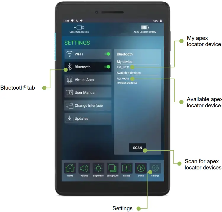 FORUMTEC Wirele X Smart Wireless Apex Locator - locator