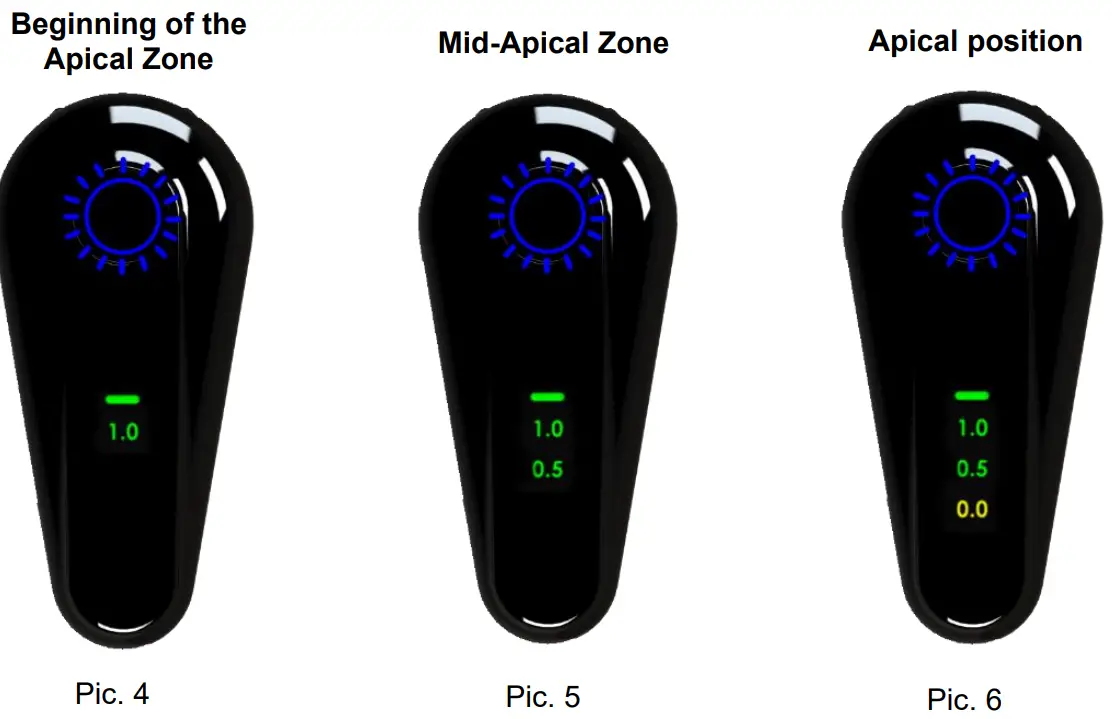 FORUMTEC Wirele X Smart Wireless Apex Locator - pic4