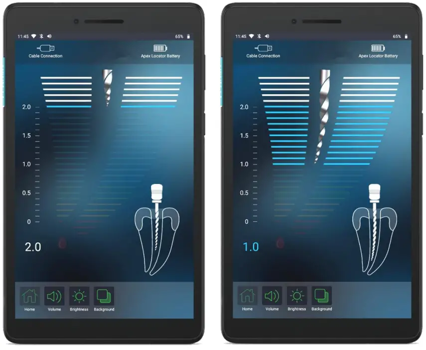 FORUMTEC Wirele X Smart Wireless Apex Locator - progression