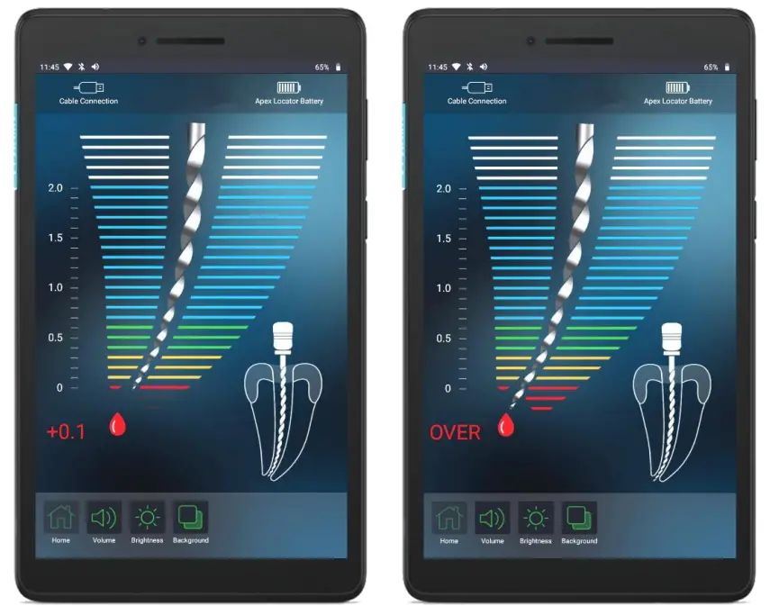 FORUMTEC Wirele X Smart Wireless Apex Locator - reading