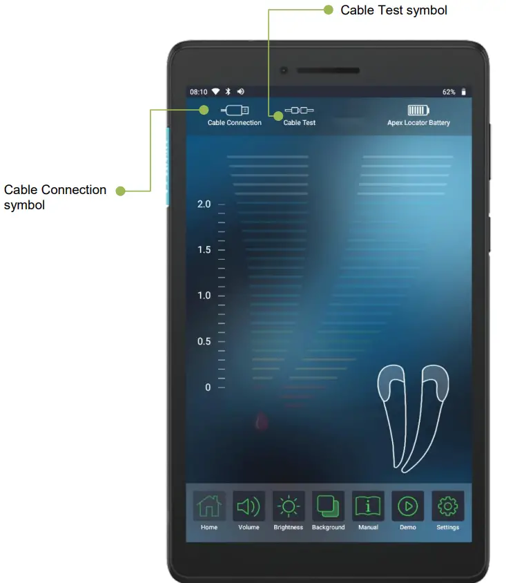 FORUMTEC Wirele X Smart Wireless Apex Locator - replaced