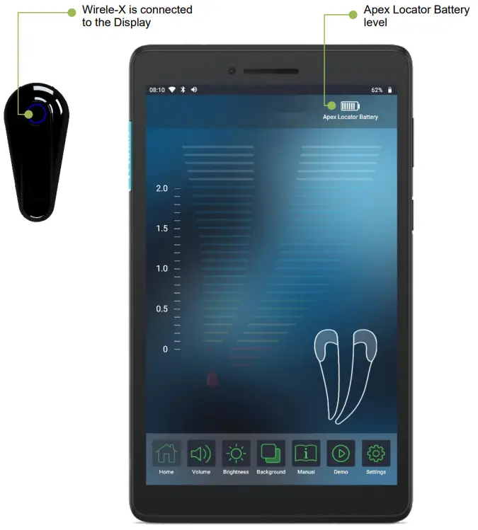 FORUMTEC Wirele X Smart Wireless Apex Locator - symbol