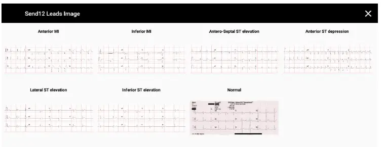 SimVS 1617201692 Simulation Platform Pre-Hospital Defibrillator-18