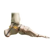 DJO-DynaNail-Helix-Fixation-System-prodect-image