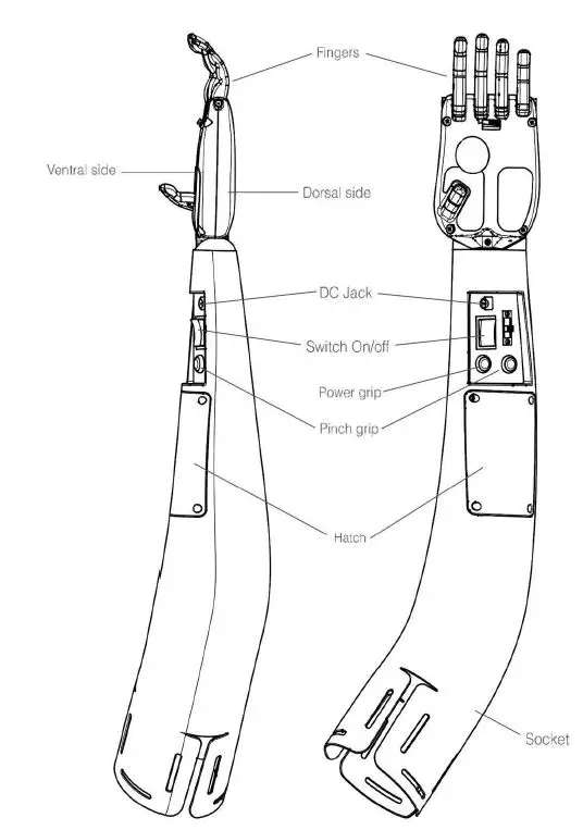 SOCIAL-HARDWARE-mitra-Elbow-Prosthesis -amp;-Wrist-Connector-FIG1