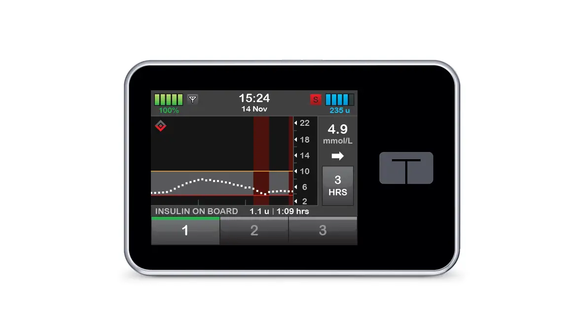 Tandem Insulin Pump Owner's Manual