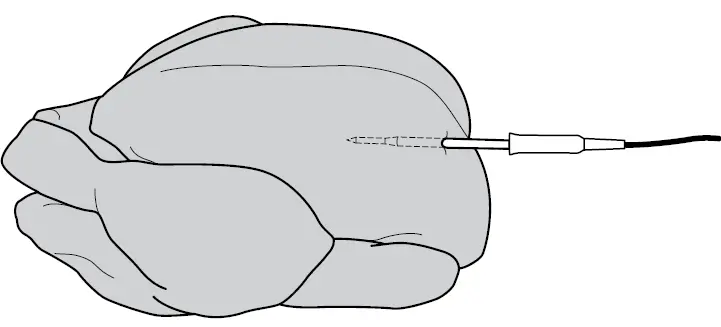 CORRECTLY INSERT THE PROBE 03