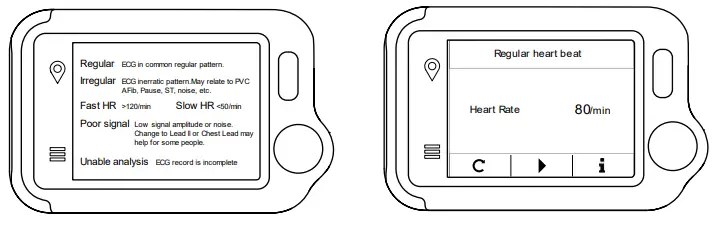 LOOKEE-Portable-ECG-Monitor-FIG-10