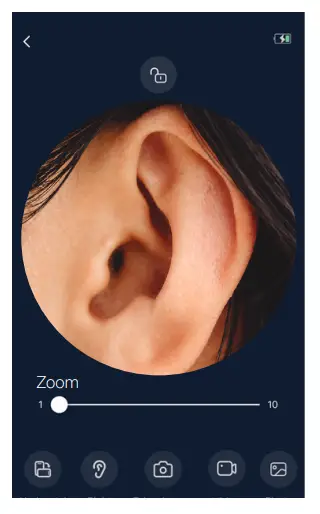 MOBI Ear Nose and Throat WiFi Otoscope HD Camera - Fig 20