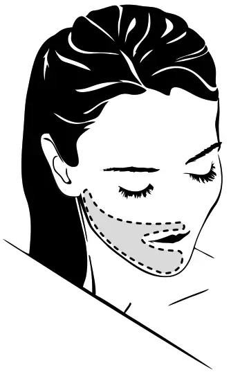 REMINGTON I-Light Compact Control Ipl Permanent Hair Removal - HAIR COLOUR 2