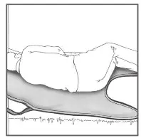 25015 Lifting Slings by Human Care with Silhouette High Back - 23