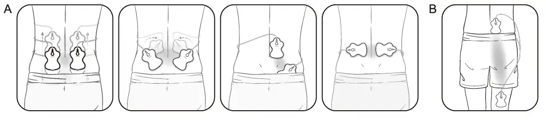 OMRON-HV-F021-Electronic-Nerve-Stimulator-FIG-11
