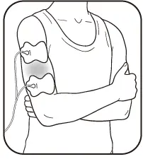 OMRON-HV-F021-Electronic-Nerve-Stimulator-FIG-12