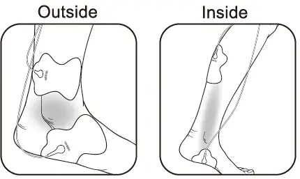 OMRON-HV-F021-Electronic-Nerve-Stimulator-FIG-17