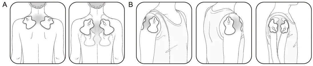 OMRON-HV-F021-Electronic-Nerve-Stimulator-FIG-18