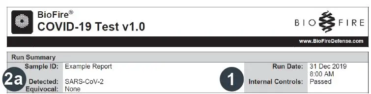 BIOFIRE 423745 Pouch Loading Station with FilmArray System fig 9