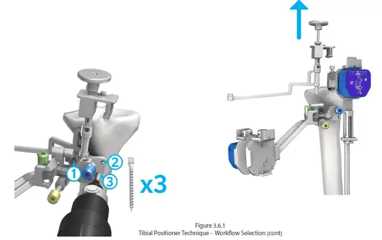orthosoft-50001-Computer-Assisted-Stereotaxic-Surgical-Instrument-System-FIG-2