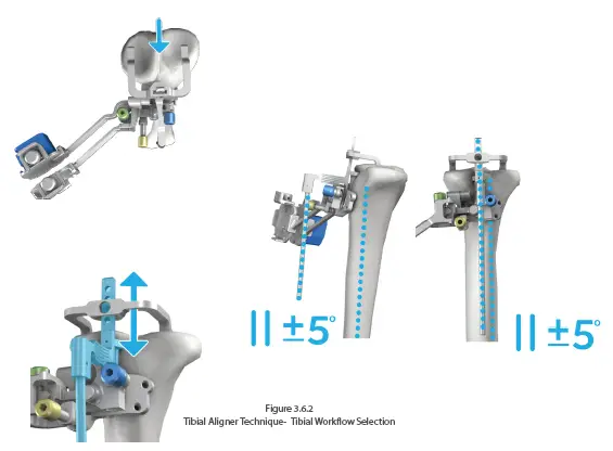 orthosoft-50001-Computer-Assisted-Stereotaxic-Surgical-Instrument-System-FIG-4
