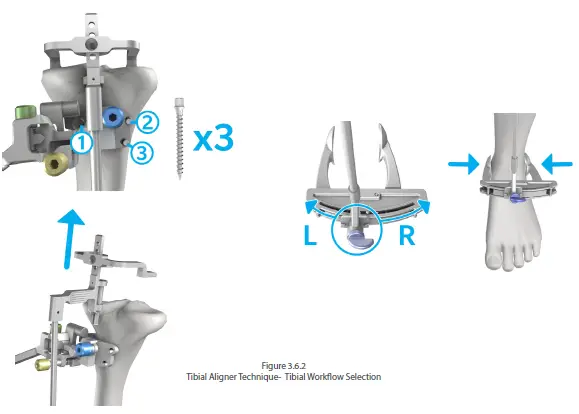 orthosoft-50001-Computer-Assisted-Stereotaxic-Surgical-Instrument-System-FIG-5