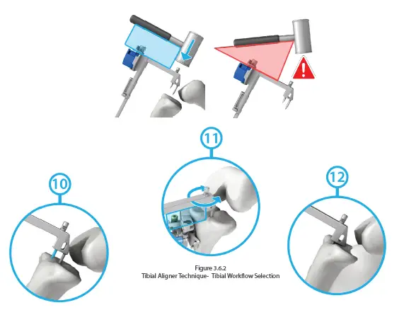 orthosoft-50001-Computer-Assisted-Stereotaxic-Surgical-Instrument-System-FIG-6