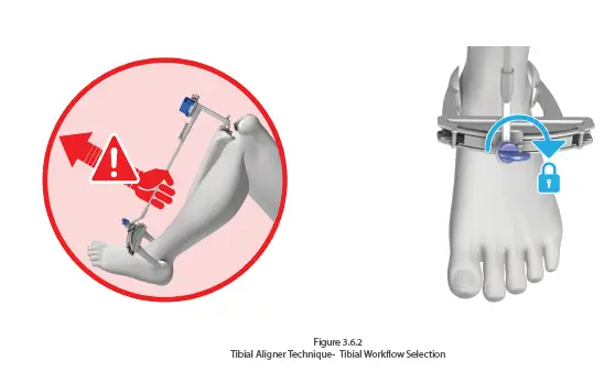 orthosoft-50001-Computer-Assisted-Stereotaxic-Surgical-Instrument-System-FIG-7