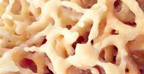 AZIYO-IFU-0006-ViBone