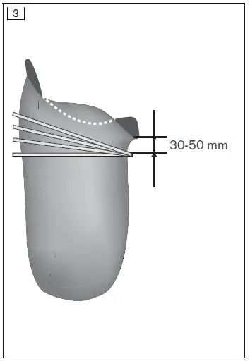 ottobock-452A1-ProSeal-Ring-3