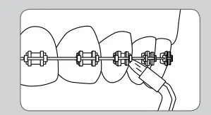 Waterpik-WT-30-Whitening-Water-Flosser-Refill-Tablets-Fig-12