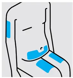 Simponi golimumab SmartJect Autoinjector- Choose injection site