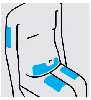 Simponi golimumab SmartJect Autoinjector- site