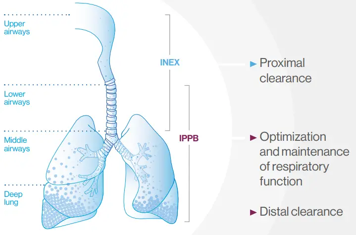 Air-Liquide-EOVETM-70-Electric-Mucus-Suction-Pump-FIG-2