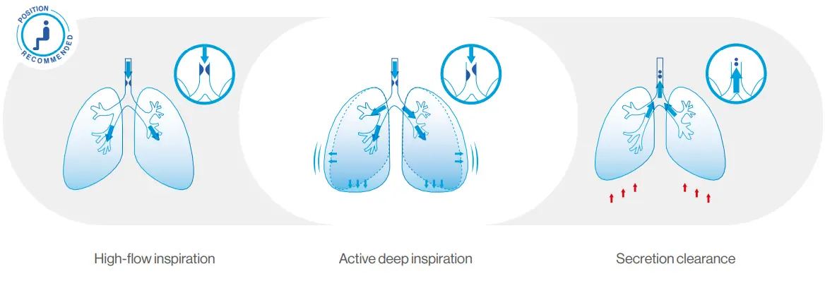 Air-Liquide-EOVETM-70-Electric-Mucus-Suction-Pump-FIG-6