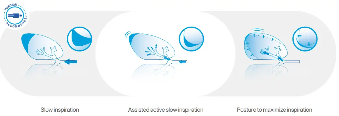 Air-Liquide-EOVETM-70-Electric-Mucus-Suction-Pump-FIG-8